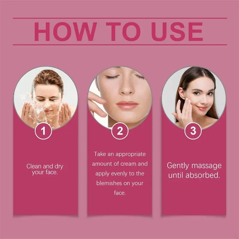 Whitening Freckle Cream Melasma Dark Spots Pigmentation Removal Products Fade Stain Melanin Repair Brighten Korean Skin Care New
