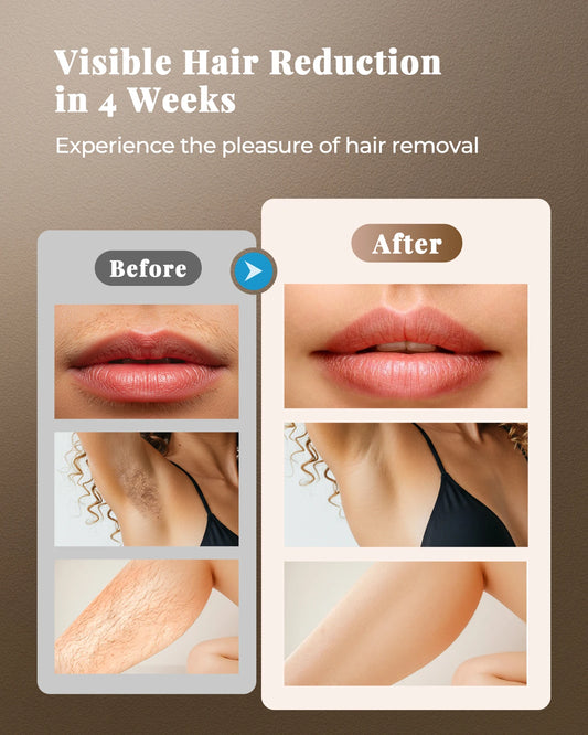 Updated Laser Hair Removal IPL Device 999900+ Flashes 21J Auto/Manual Mode for Men Women Facial Body Bikini in 4 Weeks Home Use