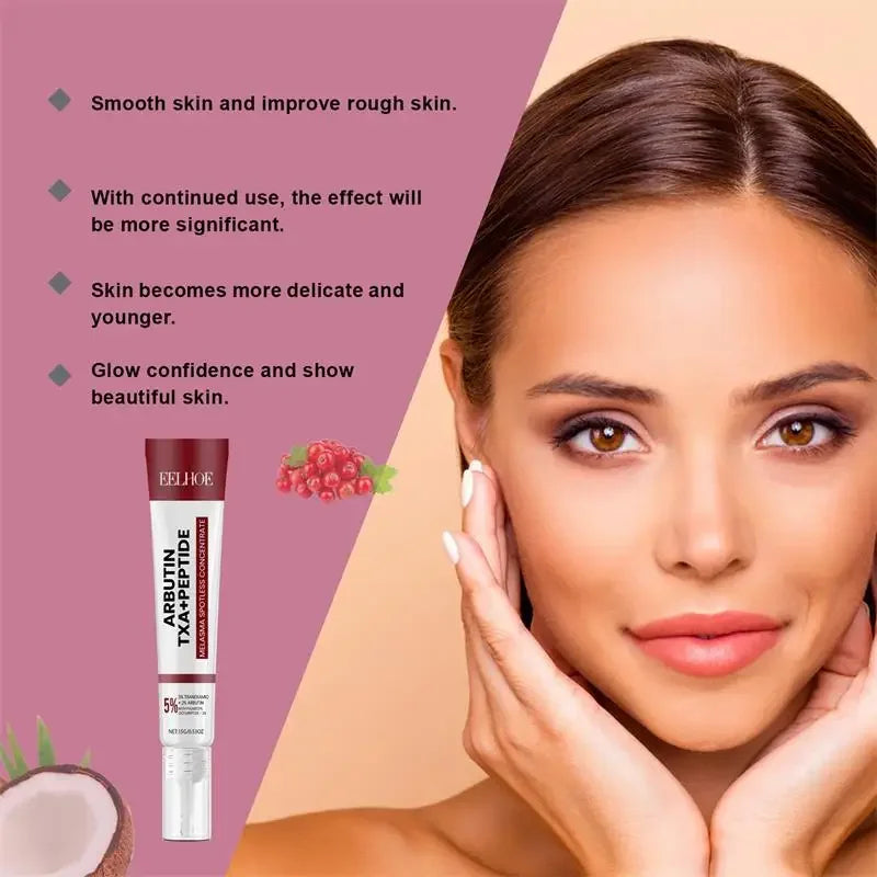 Whitening Freckle Cream Melasma Dark Spots Pigmentation Removal Products Fade Stain Melanin Repair Brighten Korean Skin Care New