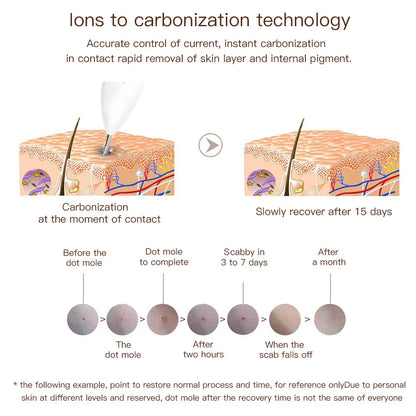 Portable 9 Levels Laser Plasma Pen Remove Pen Wart Remover Tattoo Remover Instruments Skin Tag Removal Spot Beauty Care Tool