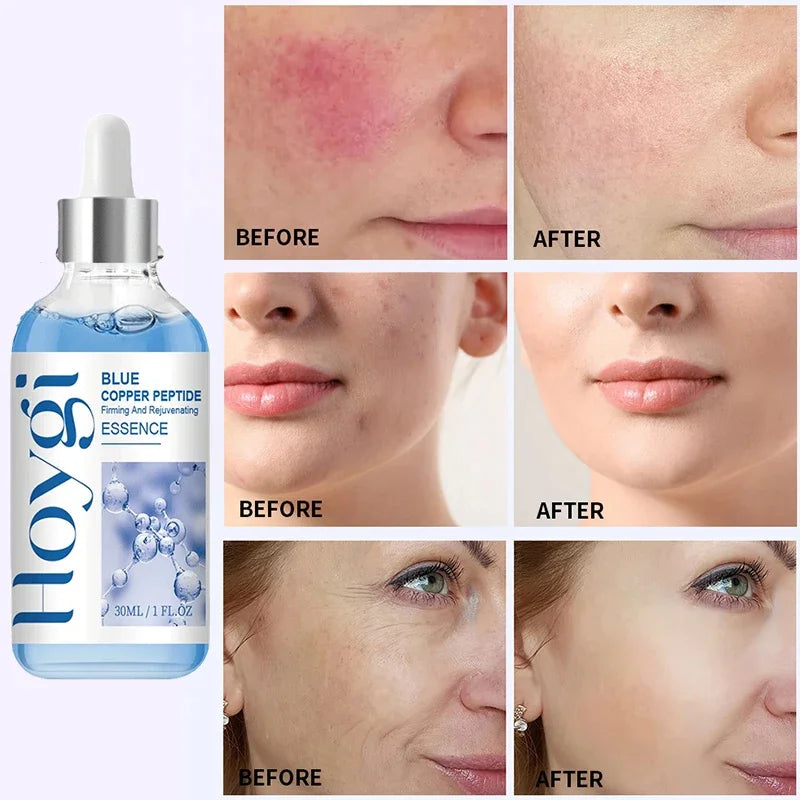 Hoygi Blue Copper Peptide Serum Anti Wrinkles Aging Rejuvenating Facial Lifting Moisturizing Brighten Skin Tone Skin Cosmetics