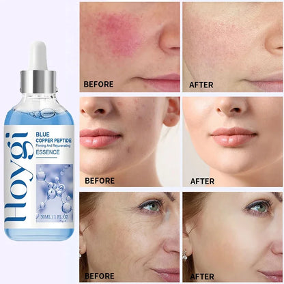 Hoygi Blue Copper Peptide Serum Anti Wrinkles Aging Rejuvenating Facial Lifting Moisturizing Brighten Skin Tone Skin Cosmetics