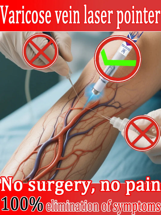 New Varicose Veins Laser Relieves Spider Legs Pain, Eliminates Vasculitis and Thrombophlebitis, Therapeutic Laser Pointer