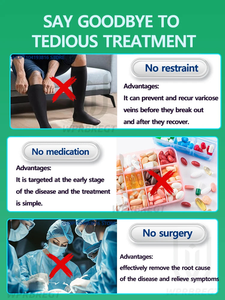 Painless removal of varicose veins, phlebitis, spider legs, prevent varicose veins, promote blood circulation