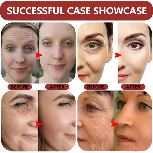 B3 Niacinamide Anti-Aging Serum Anti-Wrinkle Lifting Repair Instant Wrinkle Improve Elasticity Moisturizing Lightweight Unisex