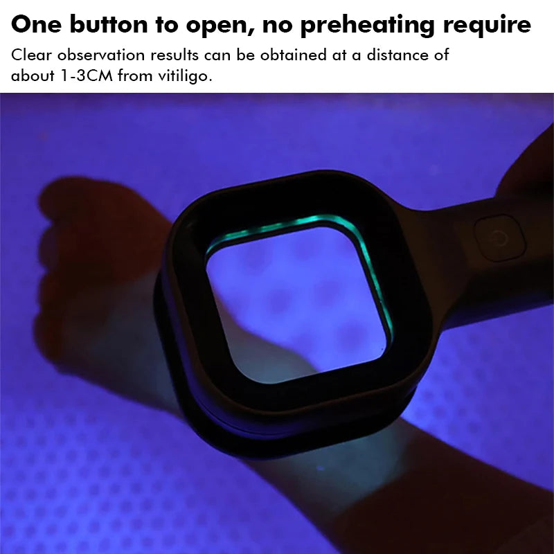 Woods Lamp Skin Analyzer Portable Facial Salon Beauty Analyzer UV Handheld Lamp for Pet Cat and Dog Skin Detection Skin care