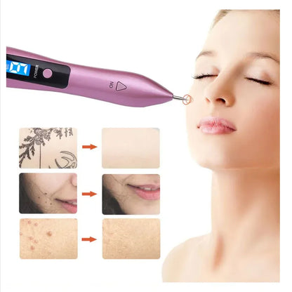 Portable 9 Levels Laser Plasma Pen Remove Pen Wart Remover Tattoo Remover Instruments Skin Tag Removal Spot Beauty Care Tool