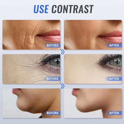 2025 Mini HIFU Radio Frequency Ultrasonic Machine EMS Micro Current Facial Beauty Instrument Firming Skin Care Anti-Wrinkle Tool