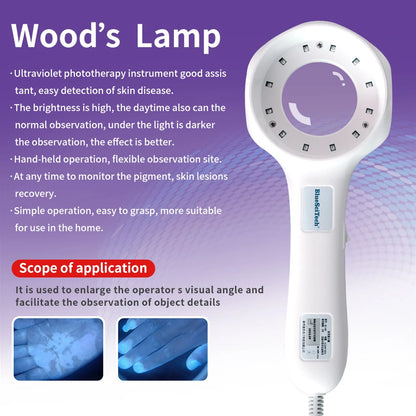 Medical Grade Led Wood Lamp Skin Analysis Magnifying Glass White Spot Detection Fungus Detection Instrument
