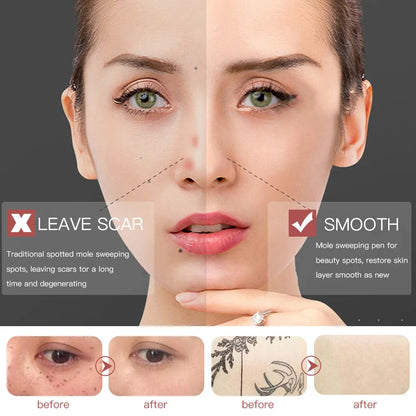 Portable 9 Levels Laser Plasma Pen Remove Pen Wart Remover Tattoo Remover Instruments Skin Tag Removal Spot Beauty Care Tool