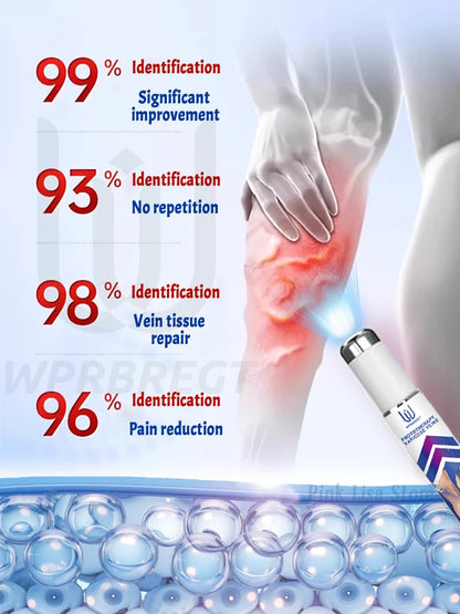 Painless removal of varicose veins, phlebitis, spider legs, prevent varicose veins, promote blood circulation