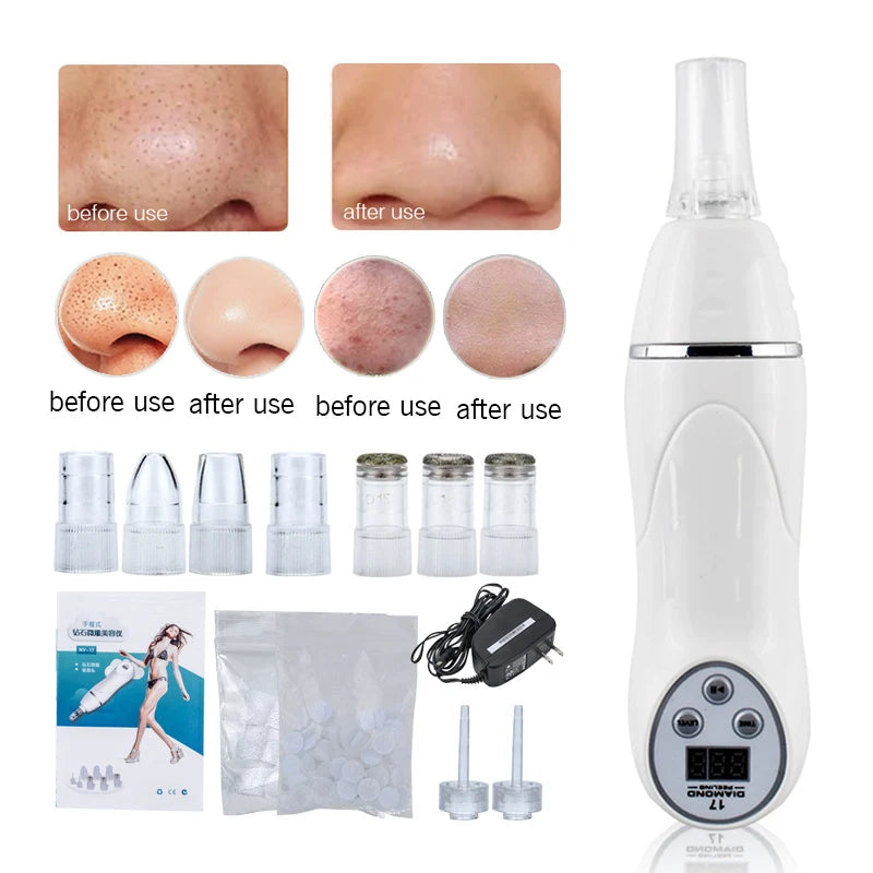 Handheld Diamond Microdermabrasion 3 Levels Machine Blackhead Acne Removal Facial Skin Care Peeling Cleaning Wrinkle Care Tool
