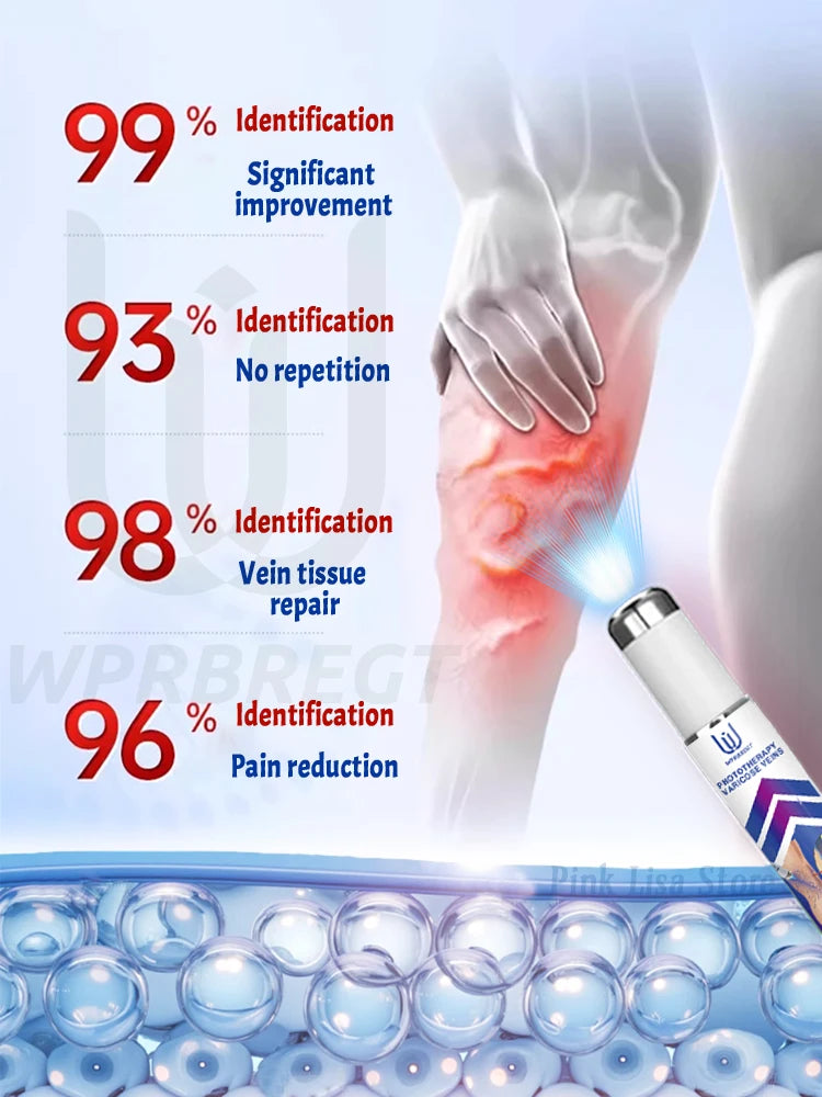 New Varicose Veins Laser Relieves Spider Legs Pain, Eliminates Vasculitis and Thrombophlebitis, Therapeutic Laser Pointer