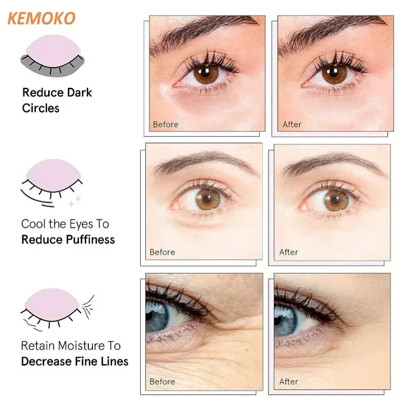 LED Micro Current Pulse Eye Massager Relieves Eye Fatigue Fades Dark Circle Anti Wrinkle Heat Therapy Eye Beauty Device Current