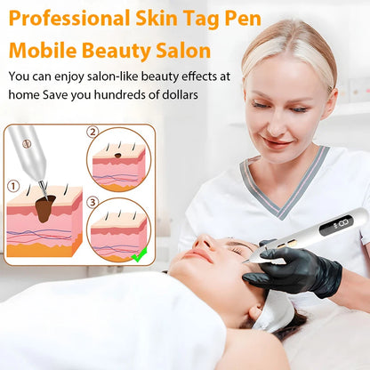 Electric Skin Tag Remover Dark Spot Mole Remover Pen Freckle Wart Tattoo Nevus Black Spots Laser Skin Tag Removal Plasma Pen